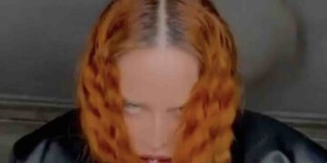 Madonna ‘Removes’ Feature From Her Face